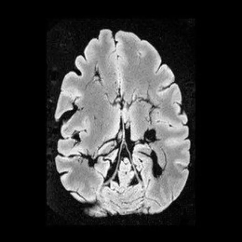 partickle.bsky.social's profile picture