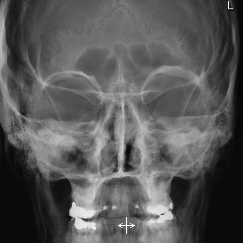 andiypsillon.bsky.social's profile picture