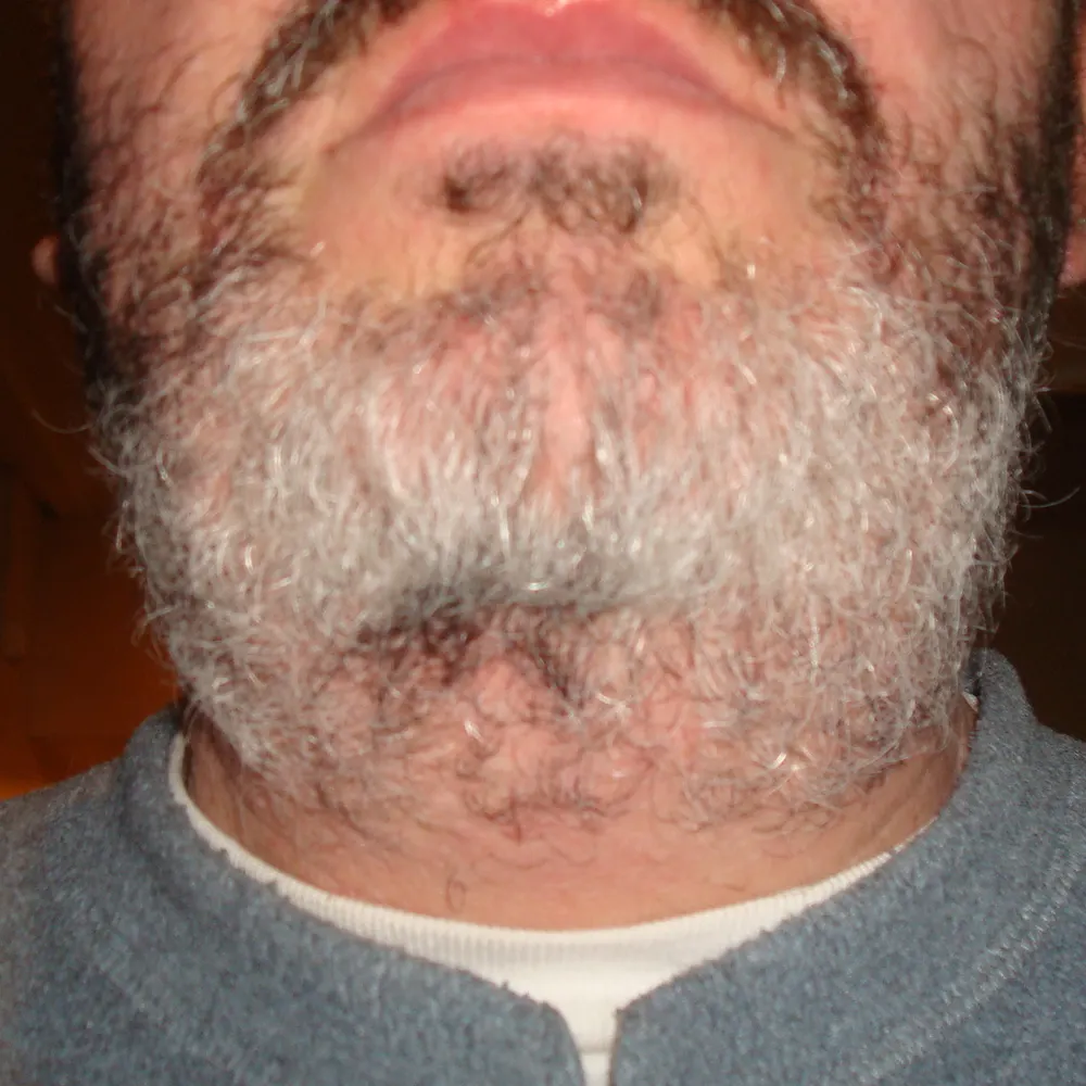 chris-in-normandie.bsky.social's profile picture