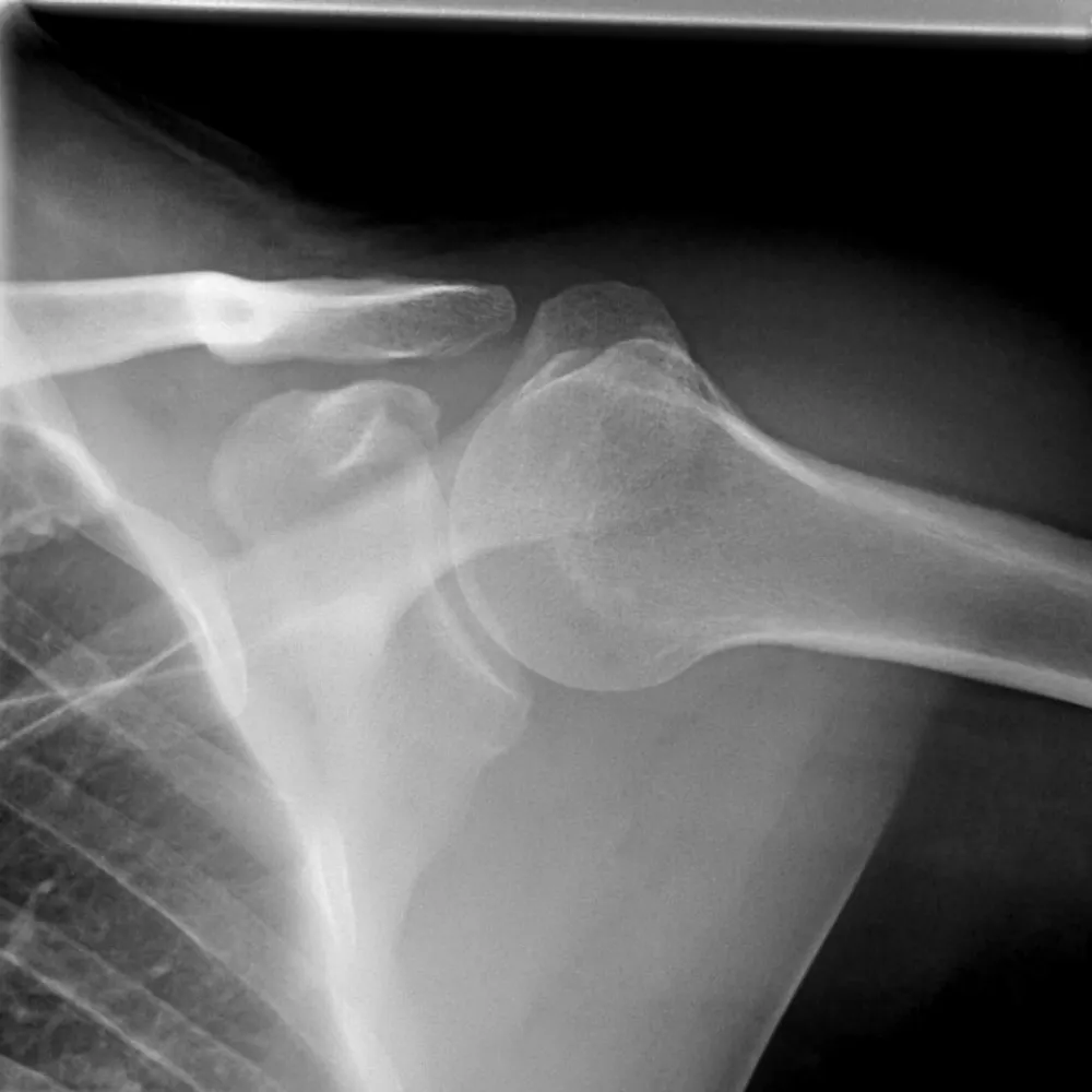 rainerschein.bsky.social's profile picture