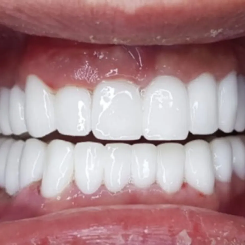 turkeyteeth008.bsky.social's profile picture