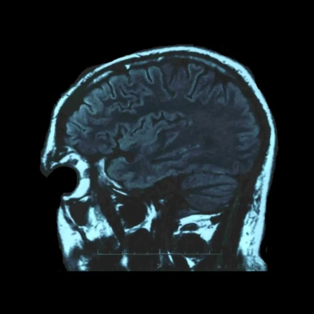 davidbofinger.bsky.social's profile picture